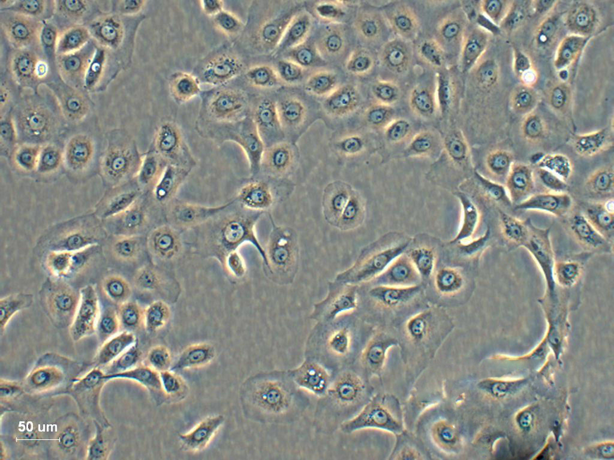 KE-39 epithelioid cells人胃癌细胞系