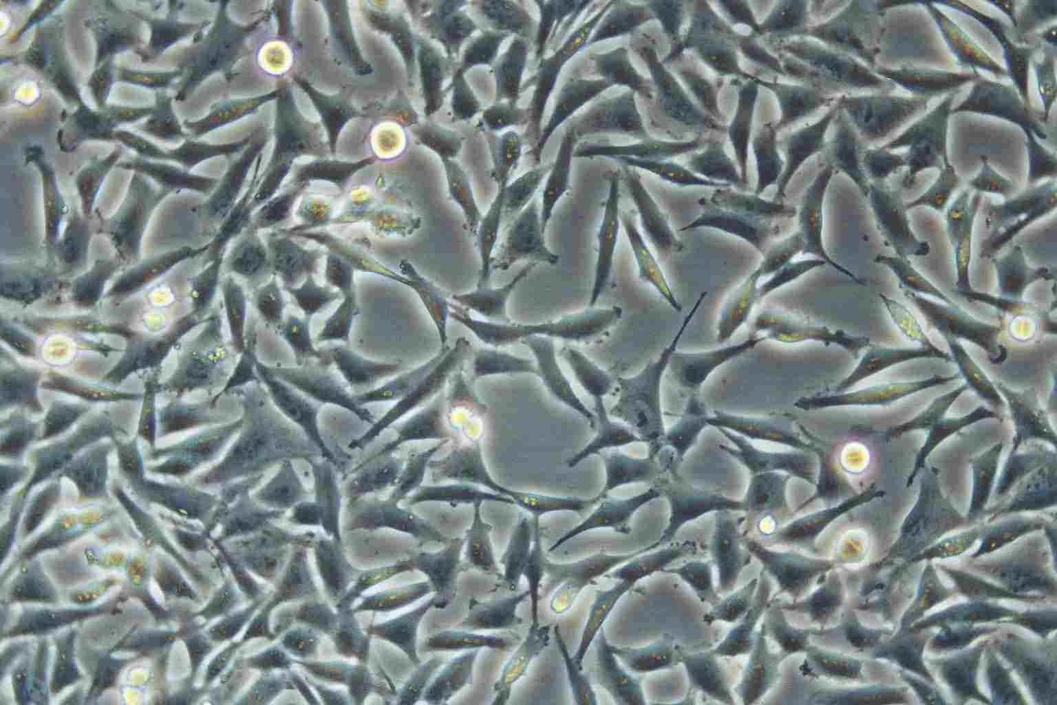 SW756 epithelioid cells人子宫鳞状癌细胞系