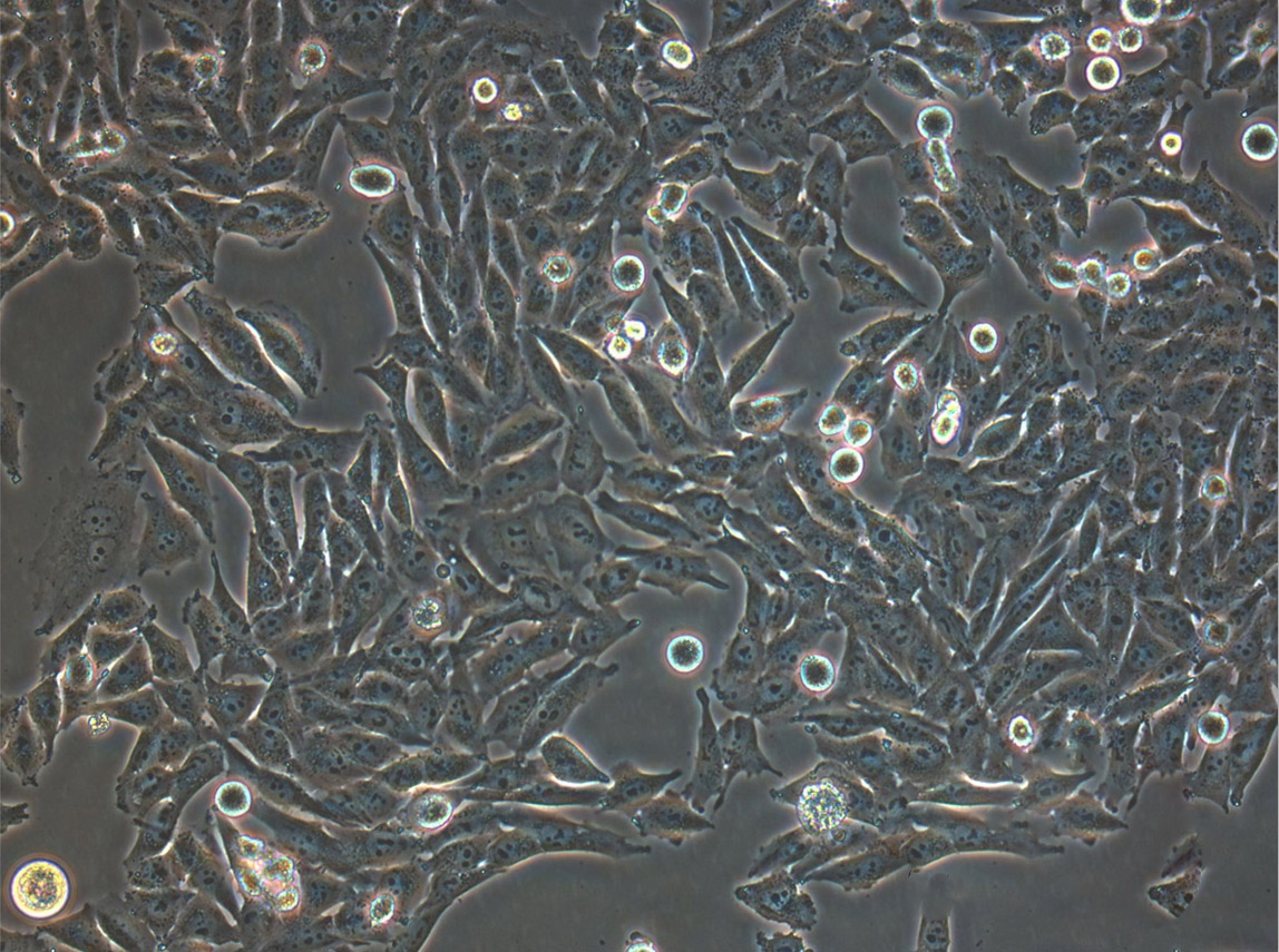 NCI-H187 Adherent人视网膜母细胞瘤细胞系