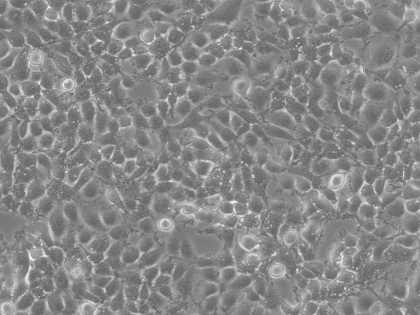 TCC-PAN2 Adherent人腹水转移癌细胞系