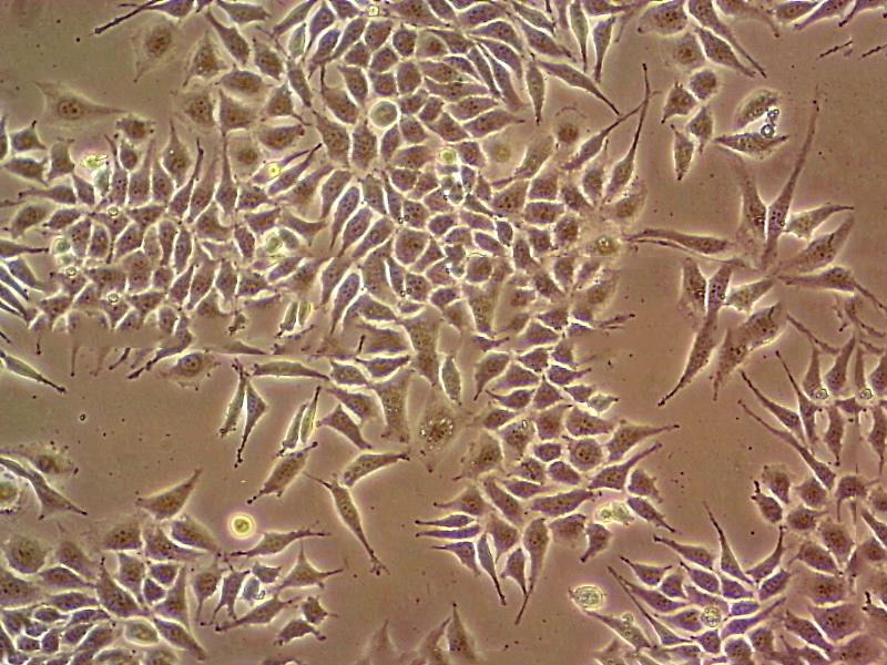 KLE Thawing人子宫内膜癌细胞系