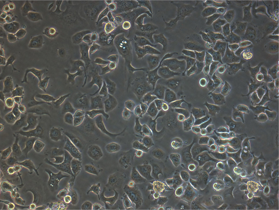 B16-F10 Thawing小鼠黑色素瘤细胞系