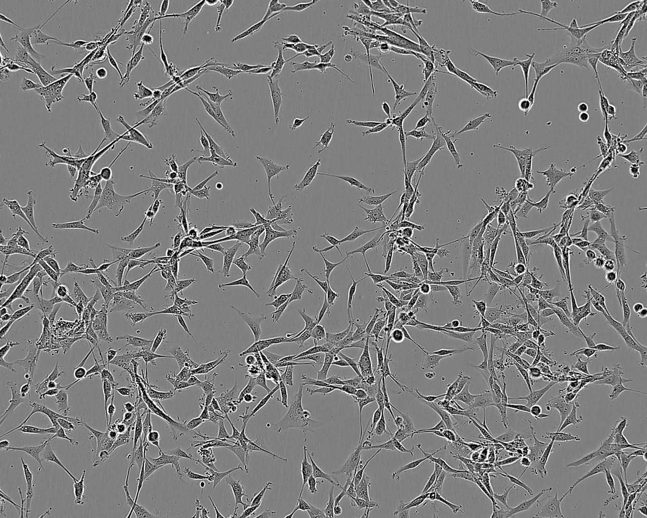 NCI-H1404 epithelioid cells人乳头状腺癌细胞系