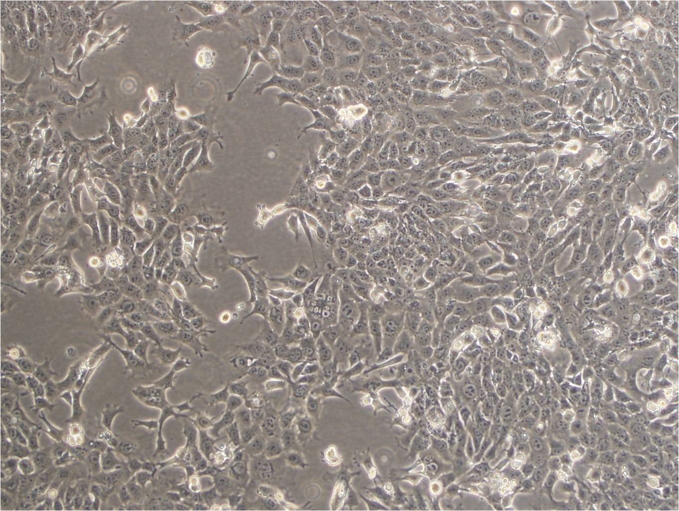 PC-10 epithelioid cells人肺鳞癌细胞系