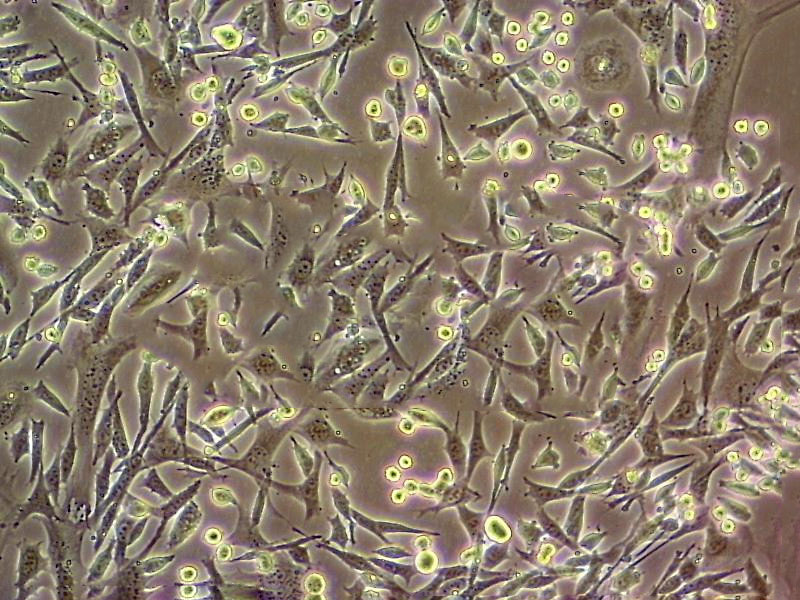 SK-LMS-1 fibroblast cells人阴户平滑肌肉瘤细胞系