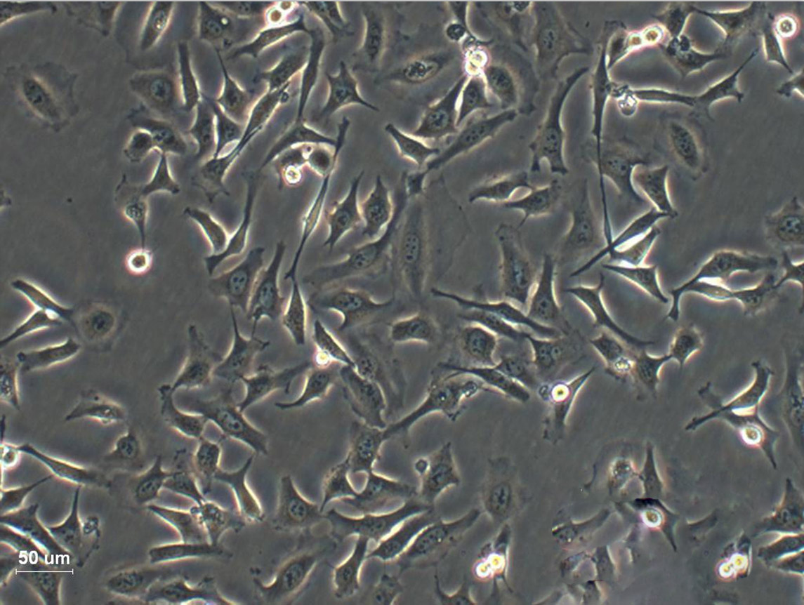 HuH-6 cell line人肝母细胞瘤细胞系