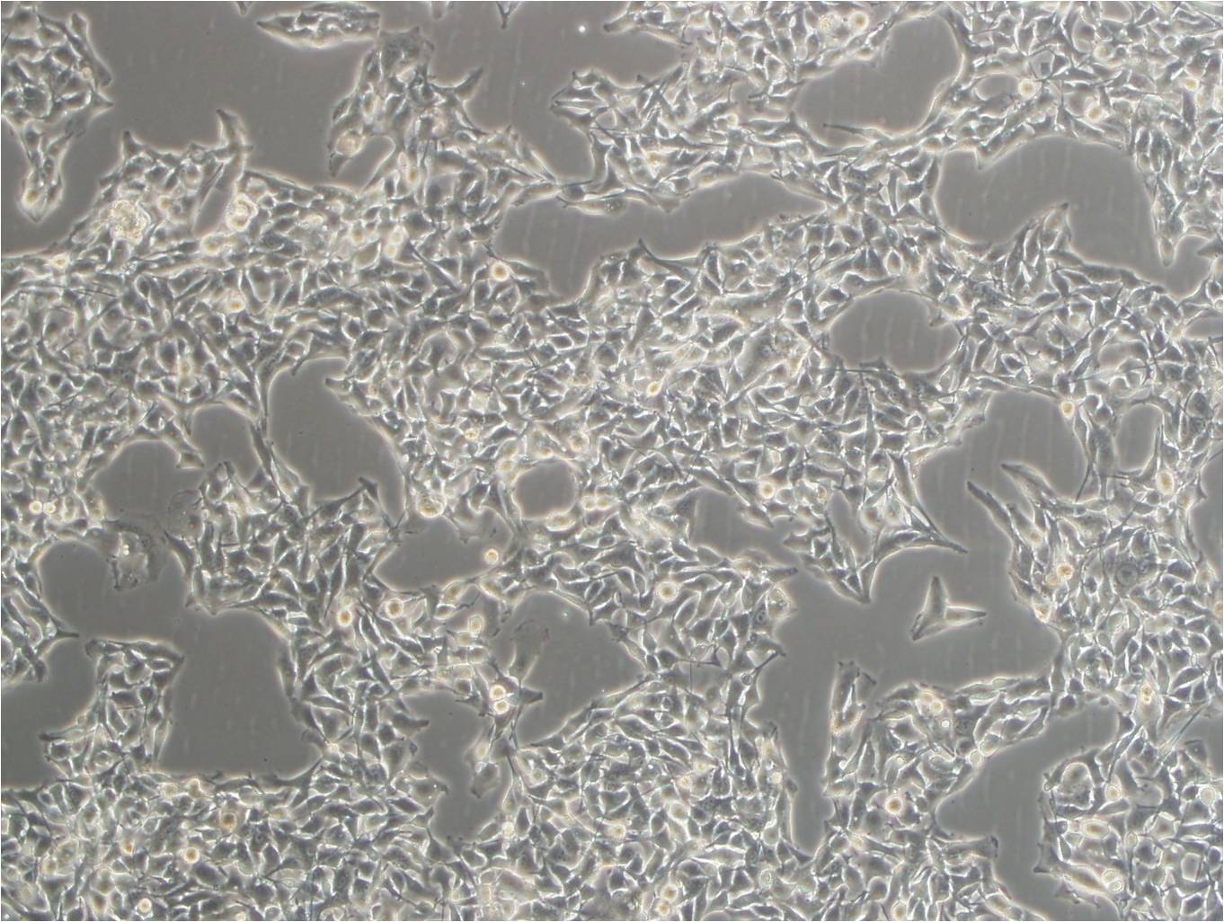 MHCC97-H cell line高转移人肝癌细胞系