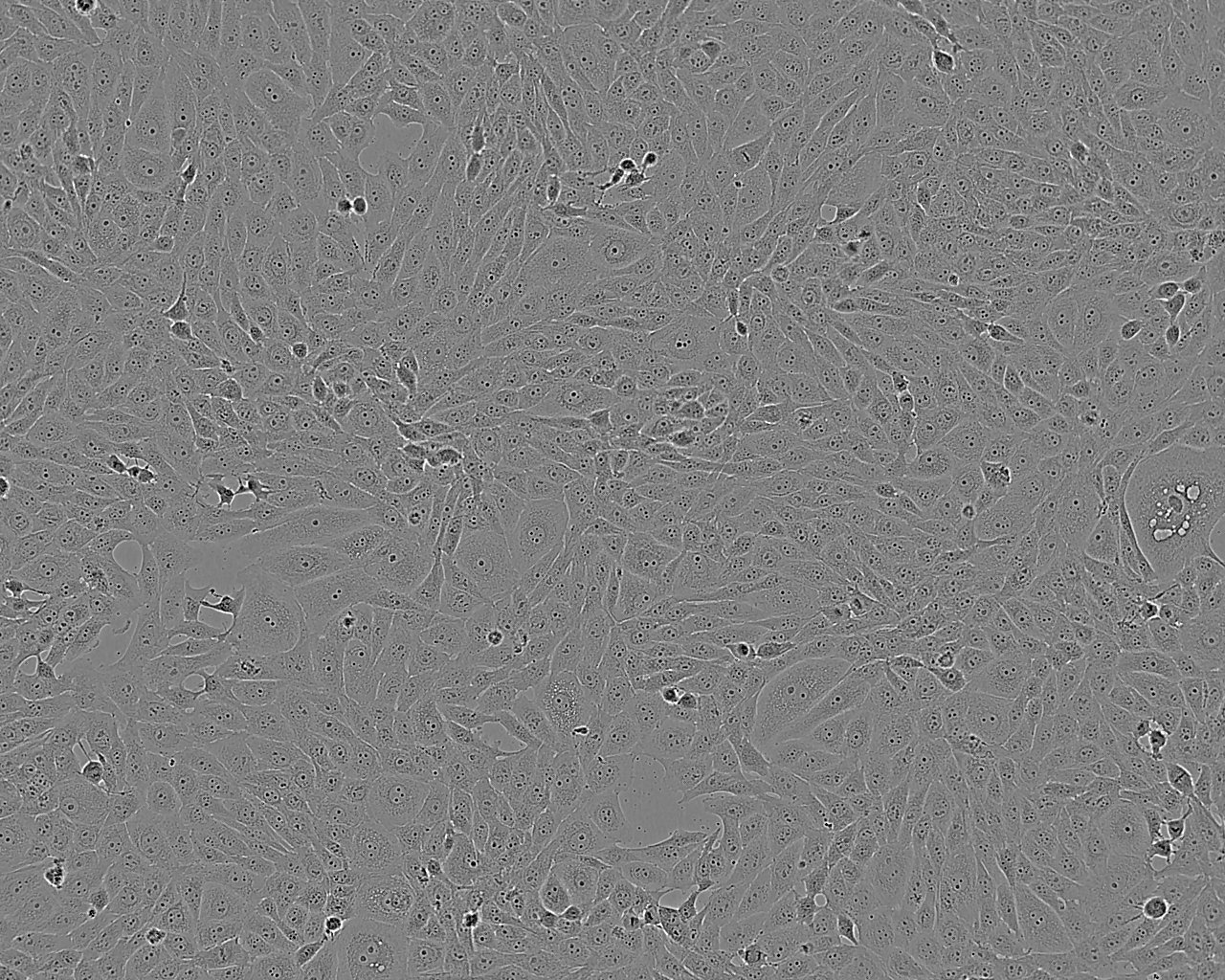 ARO Thawing人未分化甲状腺癌细胞系