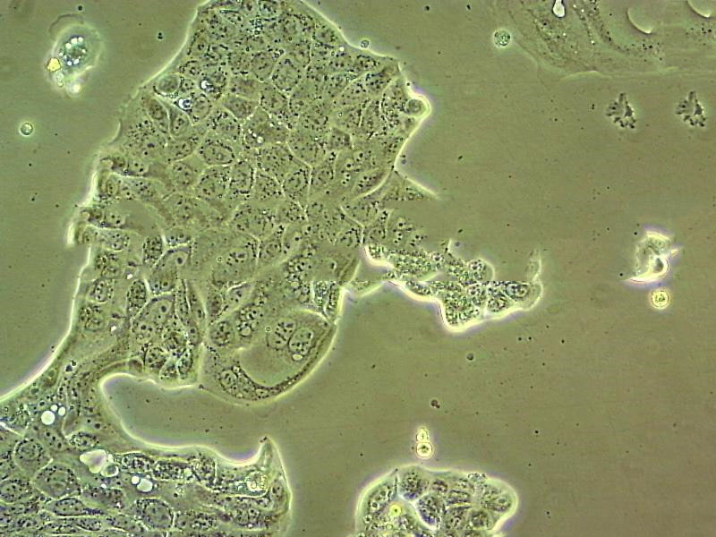 HCT 15 Thawing人结直肠腺癌细胞系