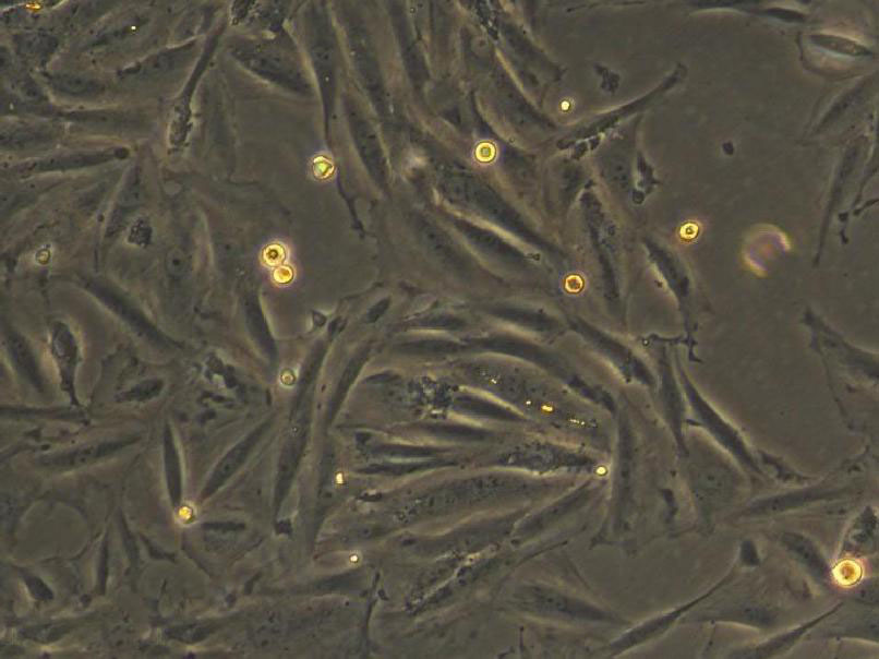 3T3-L1 Thawing小鼠前脂肪胚胎成纤维细胞系