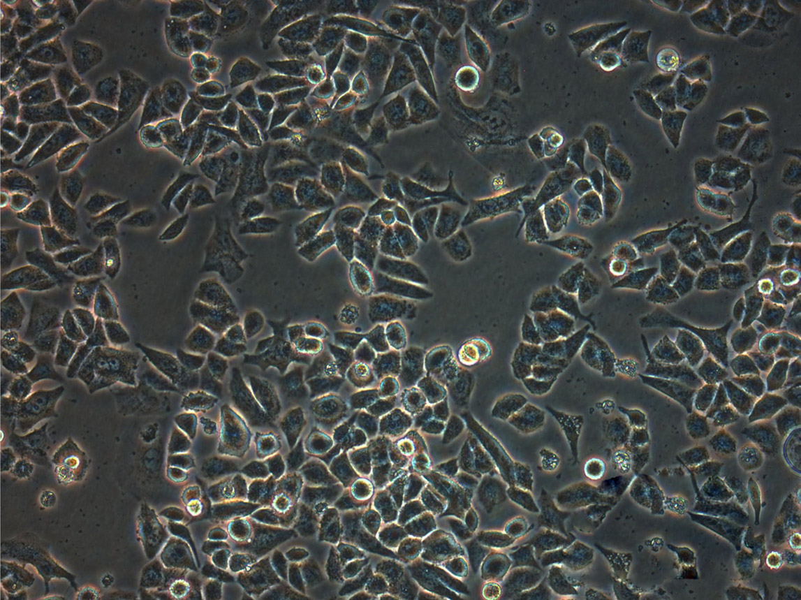 KLE cell line人子宫内膜癌细胞系