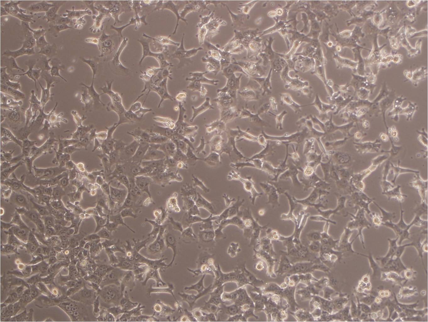 MDA-MB-134-VI cell line人乳腺导管癌细胞系