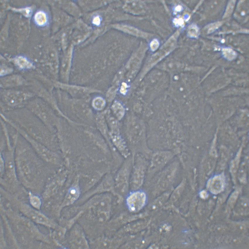 RA-FLSs Thawing类风湿关节炎成纤维样滑膜细胞系