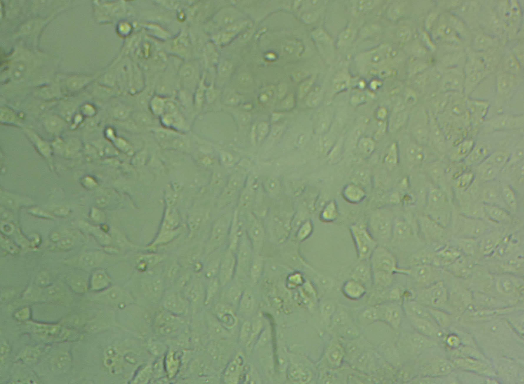 YTMLC-90 cell line人肺鳞癌细胞系