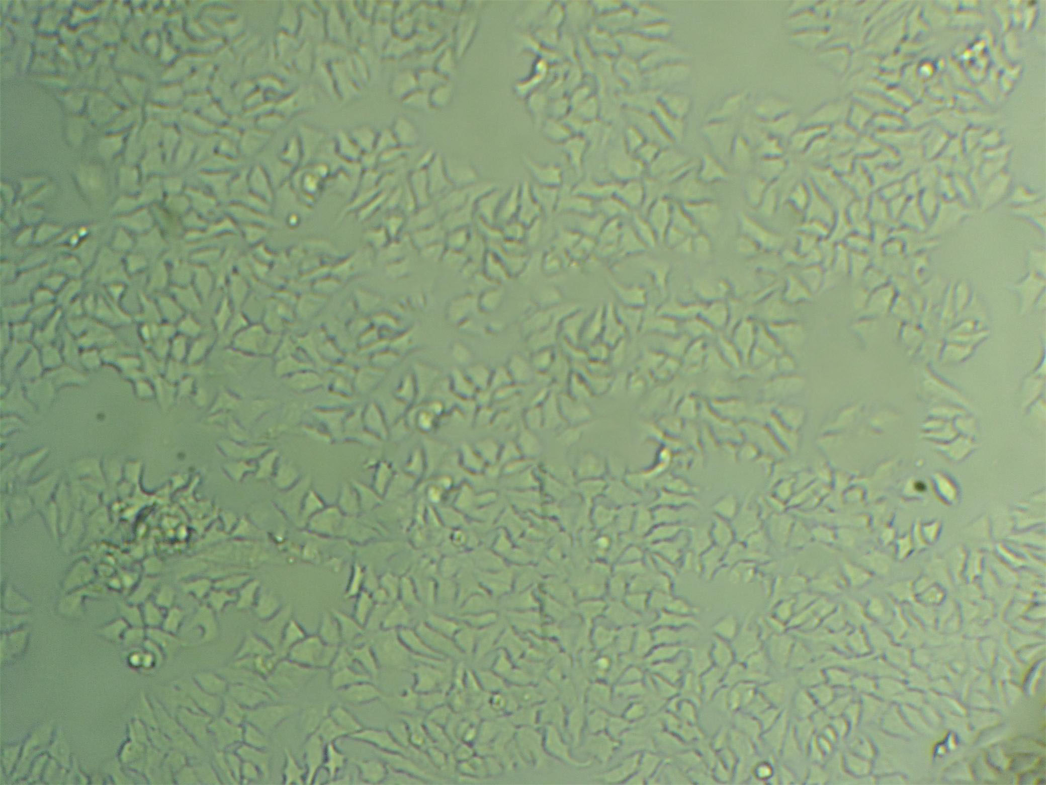 6-10B cell line人鼻咽癌细胞系
