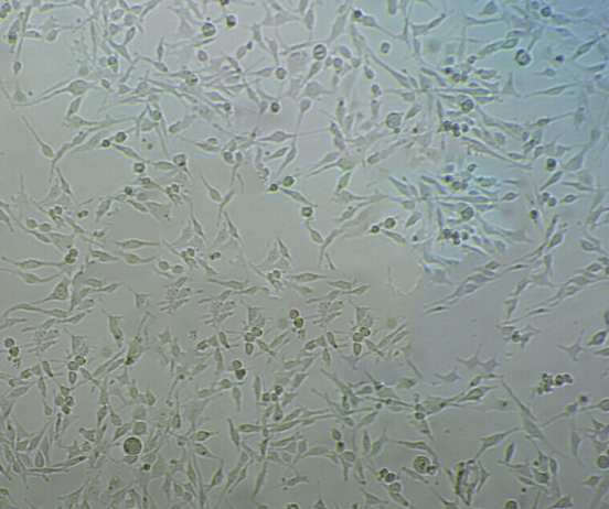 108CC15 cell line小鼠神经母瘤与大鼠胶质瘤之融合细胞系