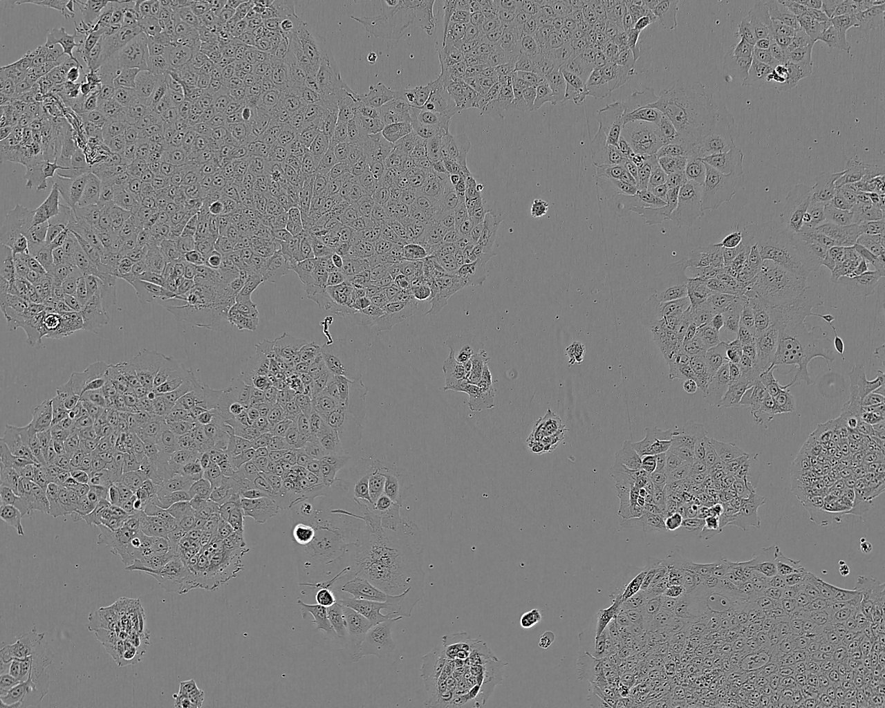 TSCC1 cell line人源口腔鳞状细胞系