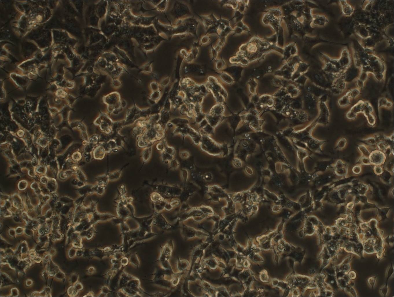 NCI-H1395 cell line人非小细胞肺癌细胞系