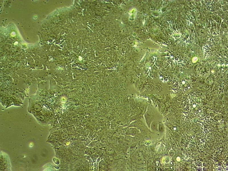 MV4-11 cell line人急性单核细胞系