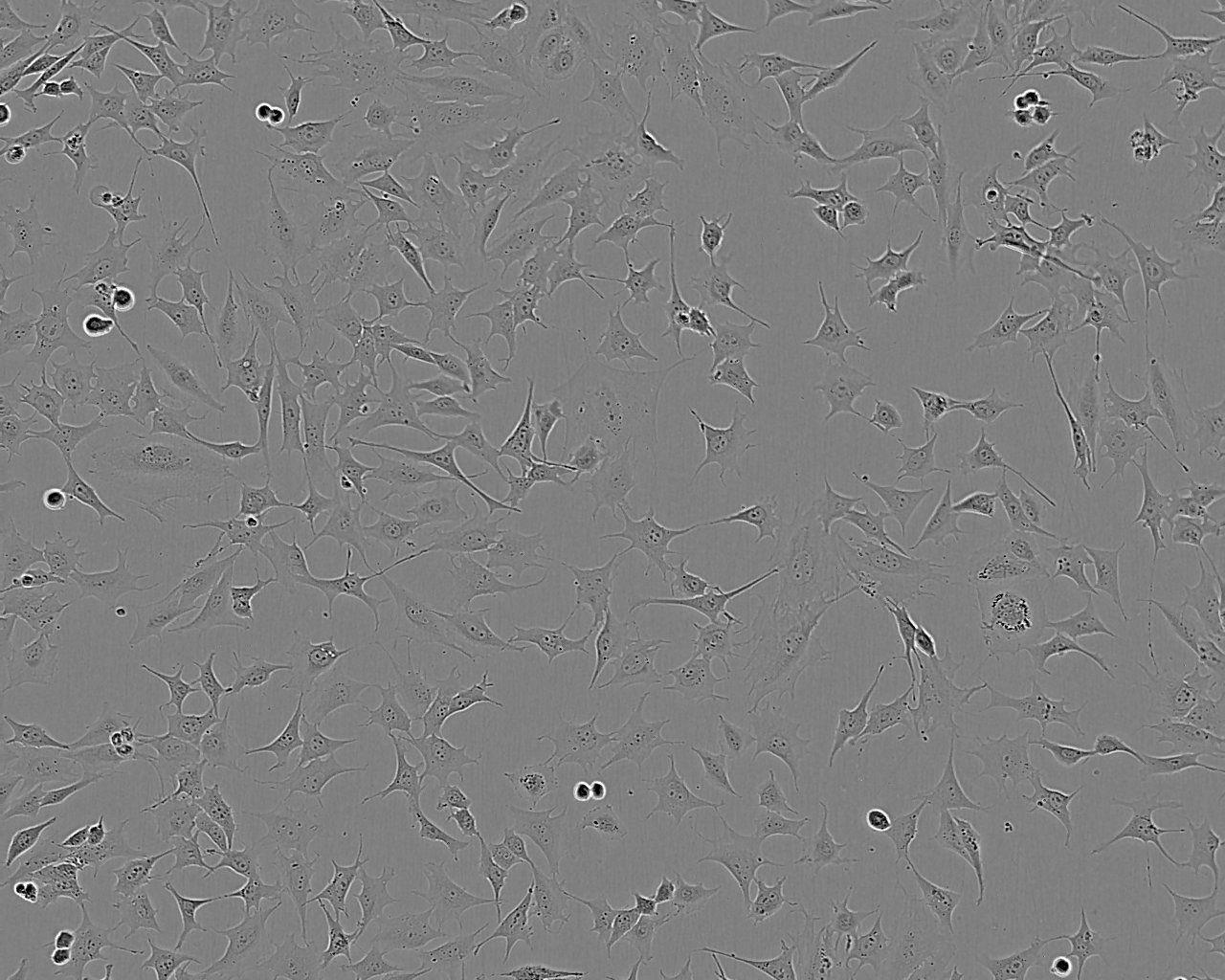VM-CUB-1 cell line人膀胱癌细胞系