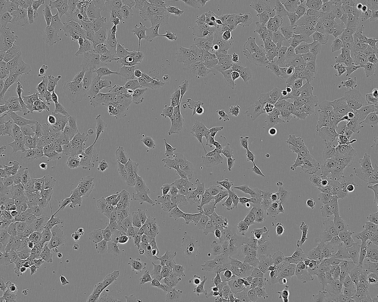 OC-3-VGH cell line人卵巢癌细胞系