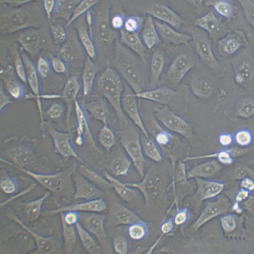 HFL1 cell line人肺成纤维细胞系