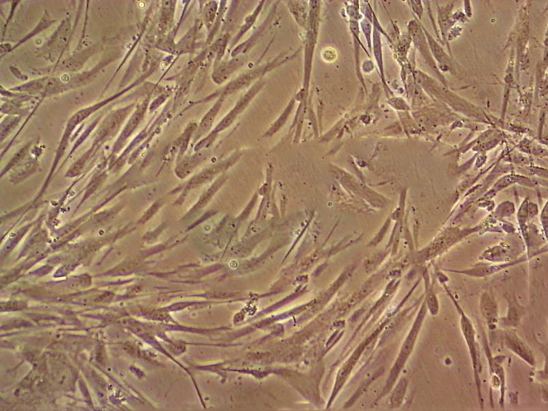 3T3-L1 cell line小鼠前脂肪胚胎成纤维细胞系