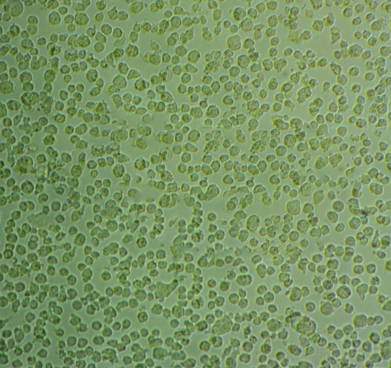 Granta-519 cell line人类B细胞淋巴癌细胞系
