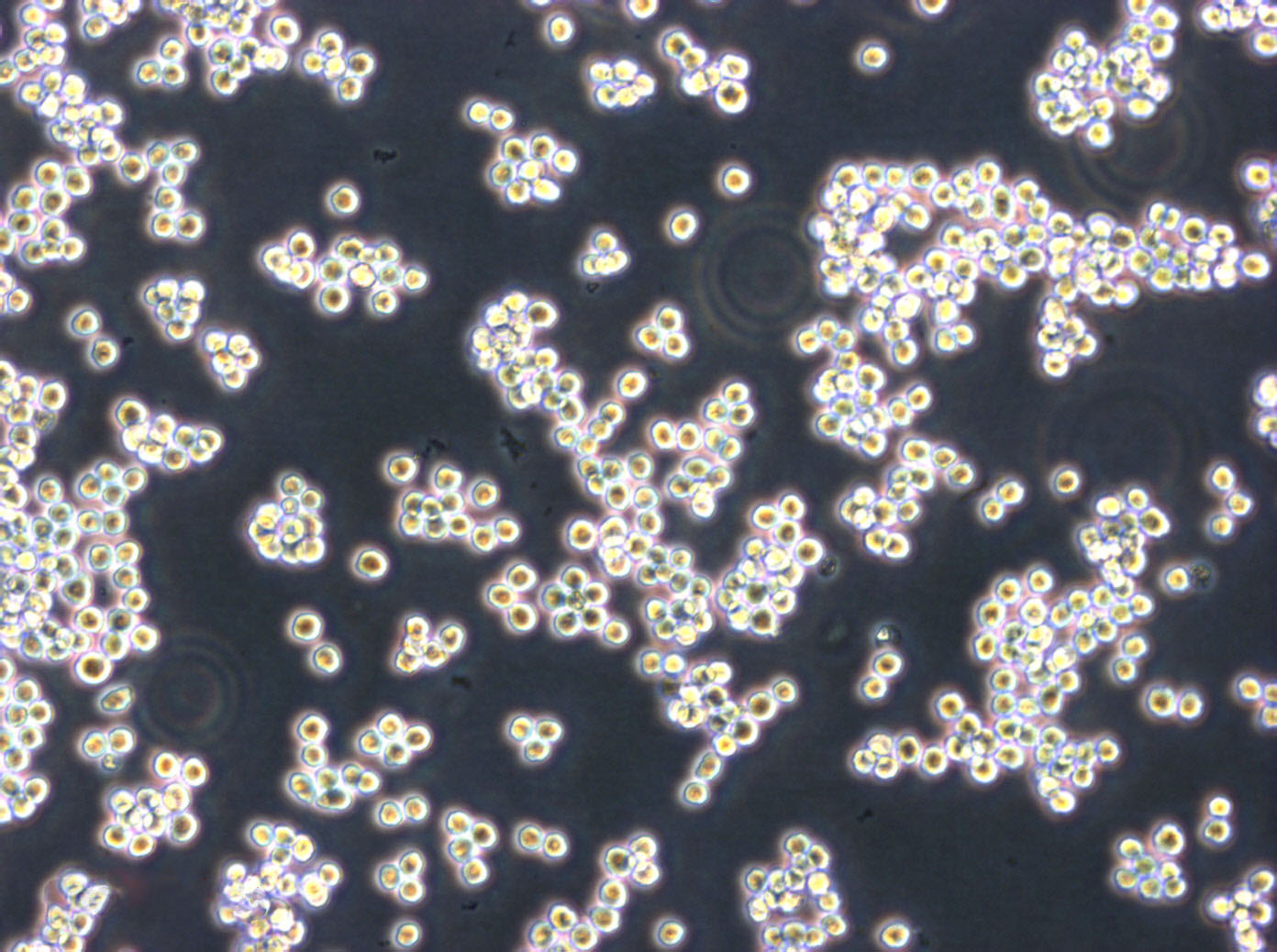 1301 cell line人急性T淋巴细胞白血病细胞系