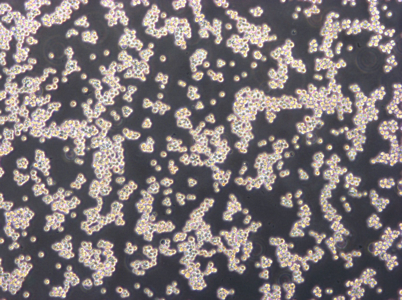 U-2932 cell line人弥漫大B淋巴瘤细胞系