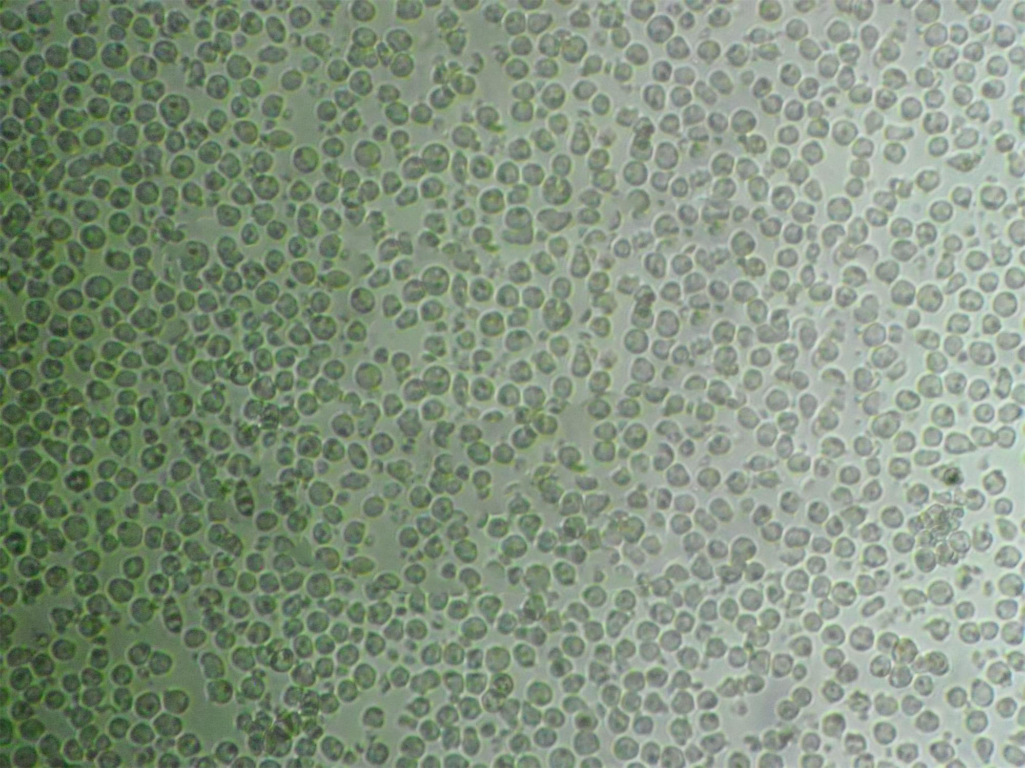 WSU-DLCL2 cell line人弥漫大B淋巴瘤细胞系