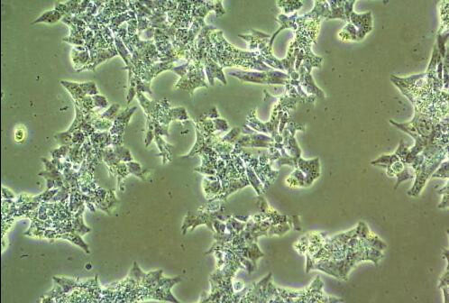 T24 人膀胱移行细胞癌细胞系