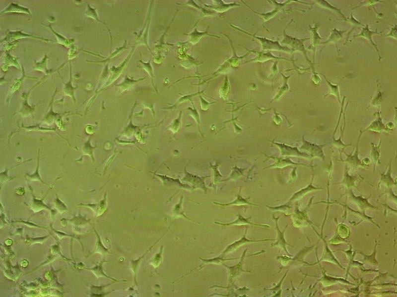 OE21 人食道鳞状癌细胞系