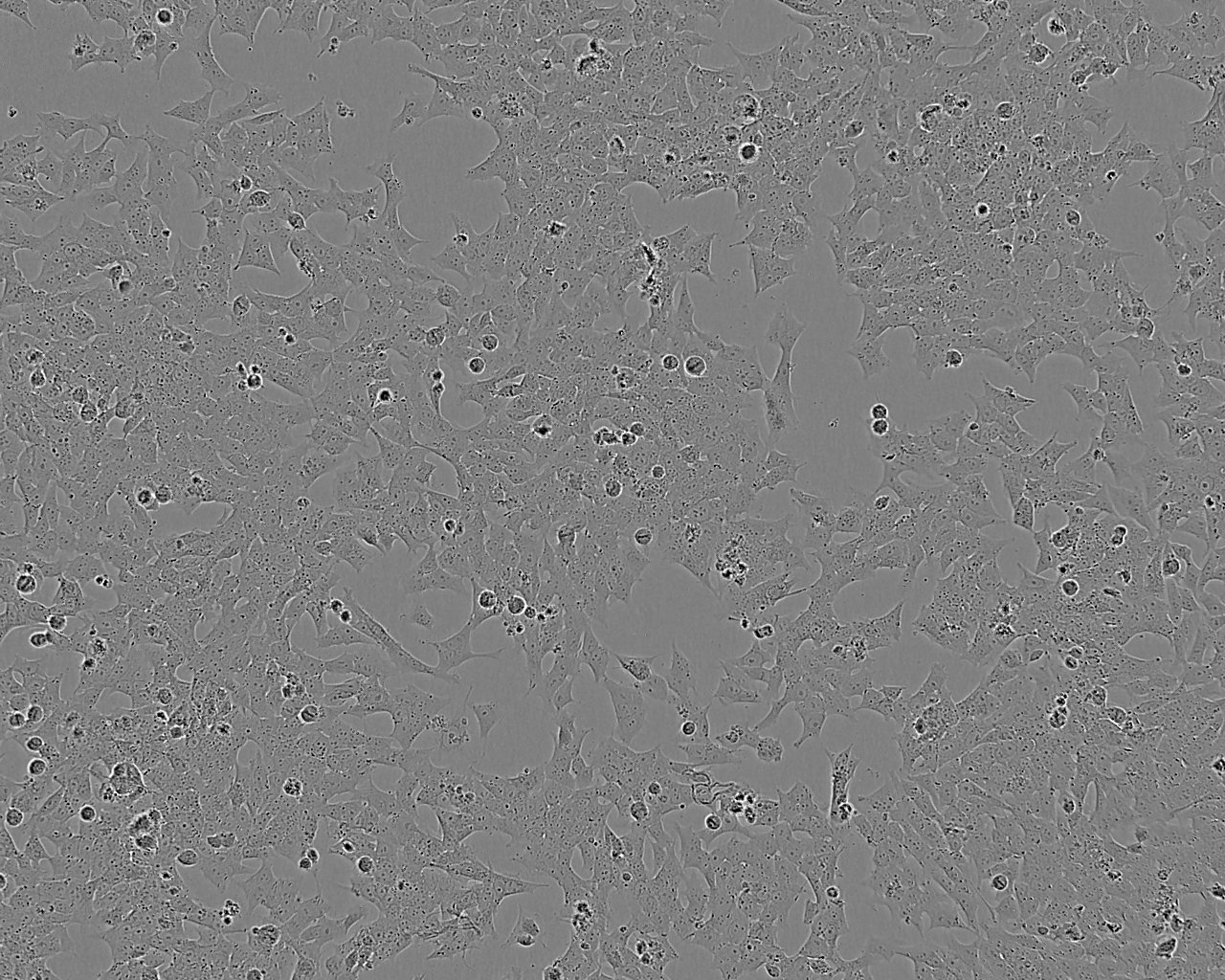 A2058 人黑色素瘤细胞系