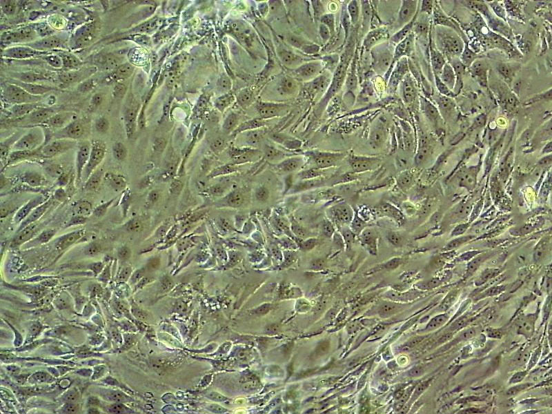 DMS 53 人小细胞肺癌细胞系