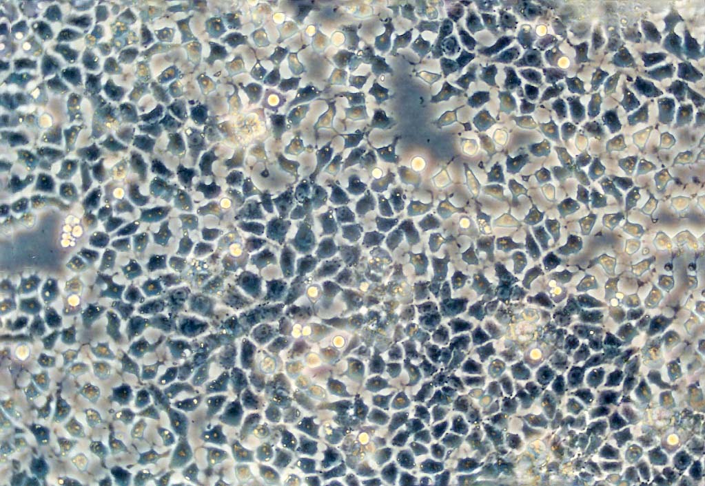 TE-14 cell line人食管癌细胞系