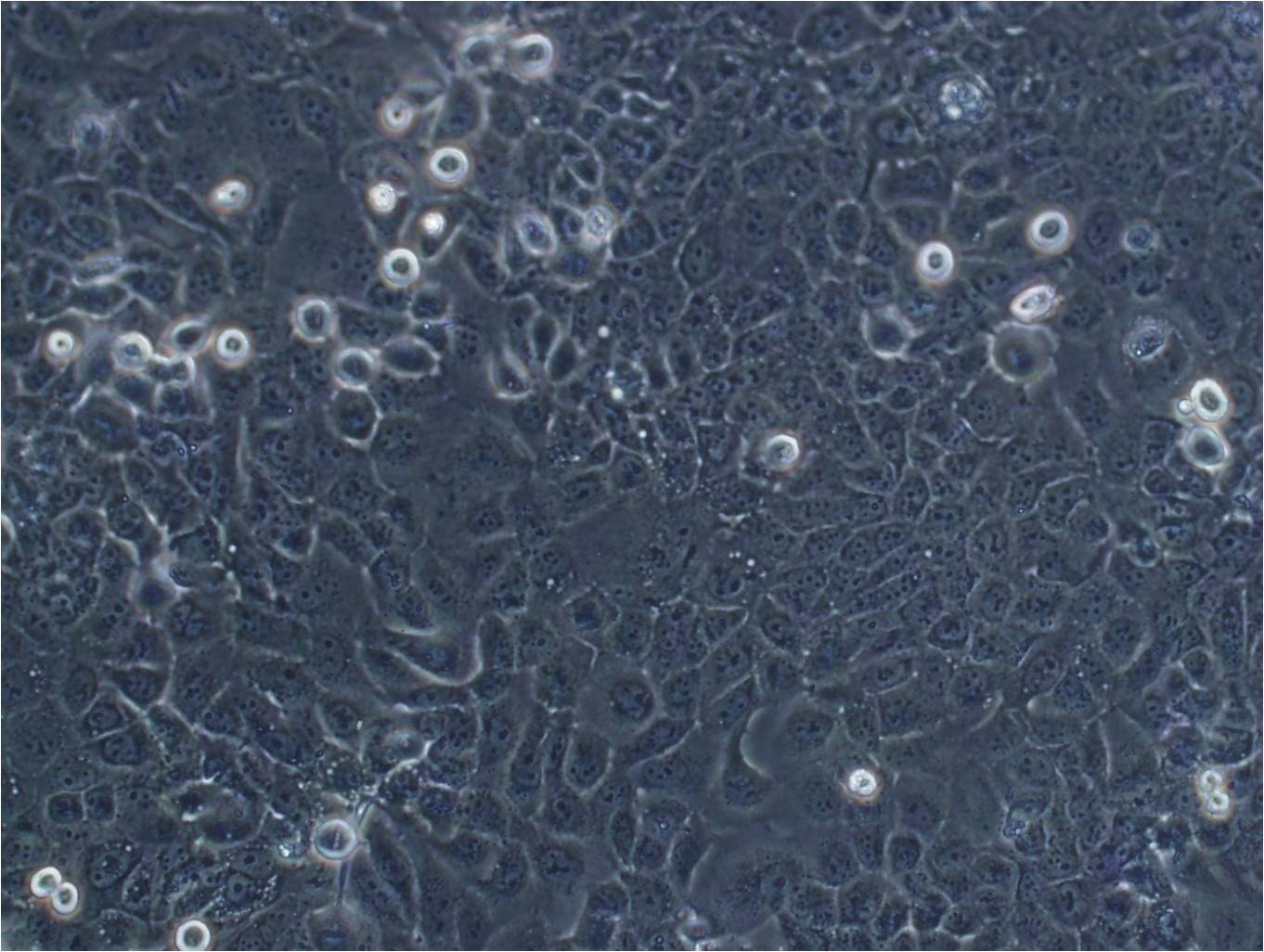 TE-4 cell line人食管癌细胞系