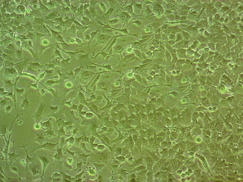 COR-L279 人肺小细胞癌细胞系