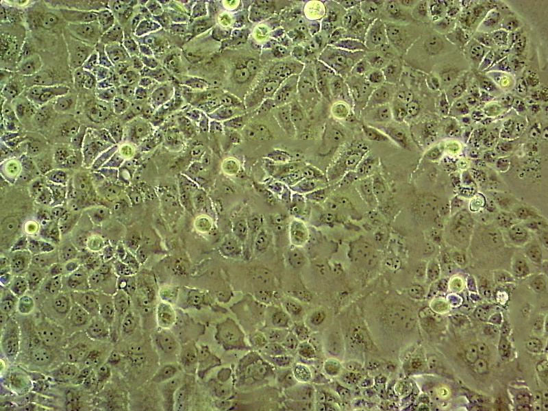 HCC78 人肺腺癌细胞系