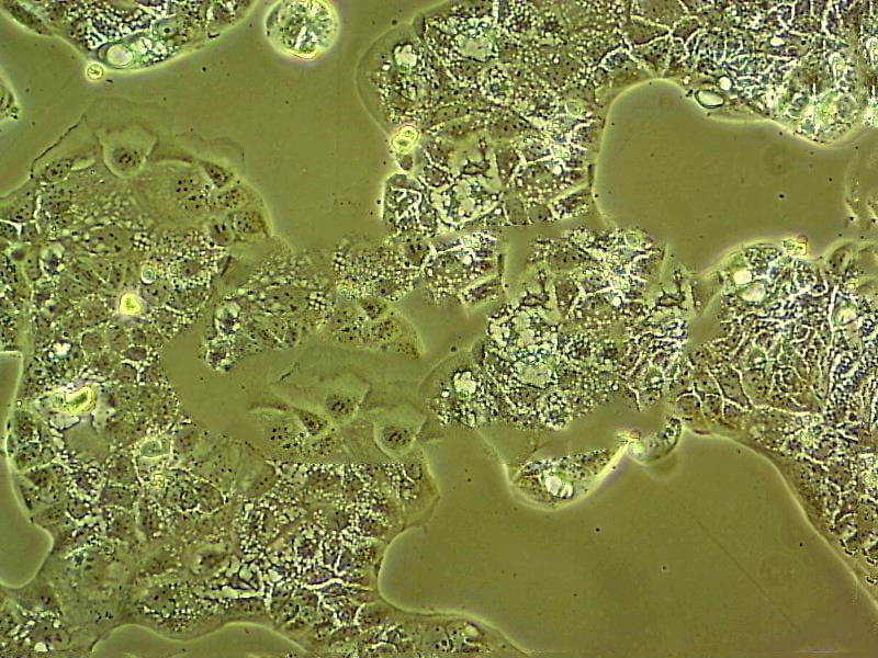 TE 671 人胚胎横纹肌瘤细胞系