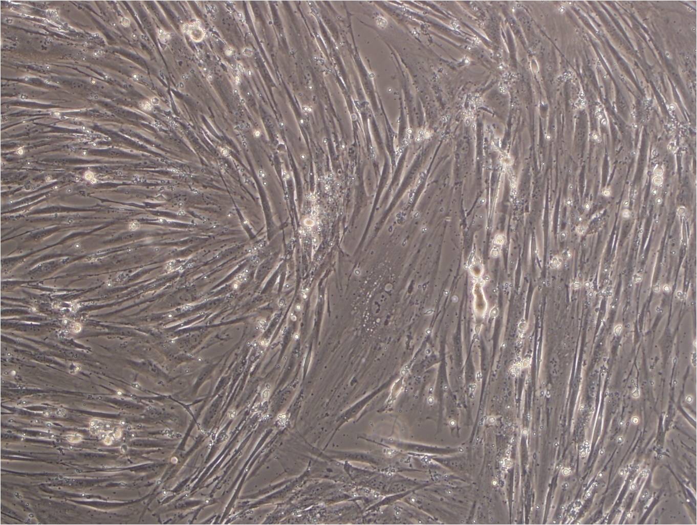SK-LMS-1 人阴户平滑肌肉瘤细胞系