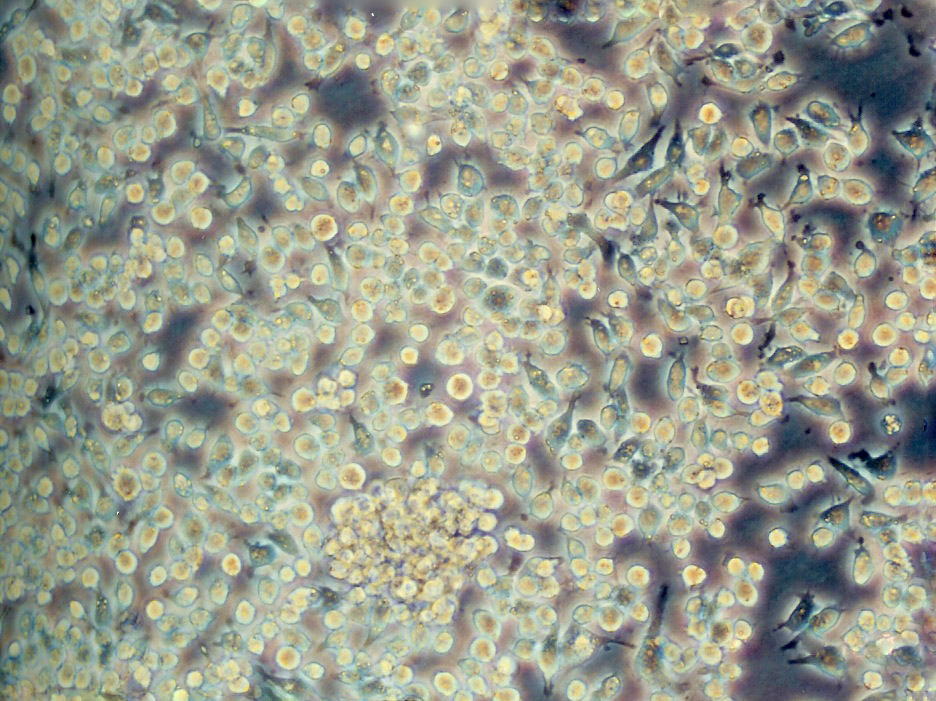 Karpas-299 人间变性大细胞淋巴瘤细胞系