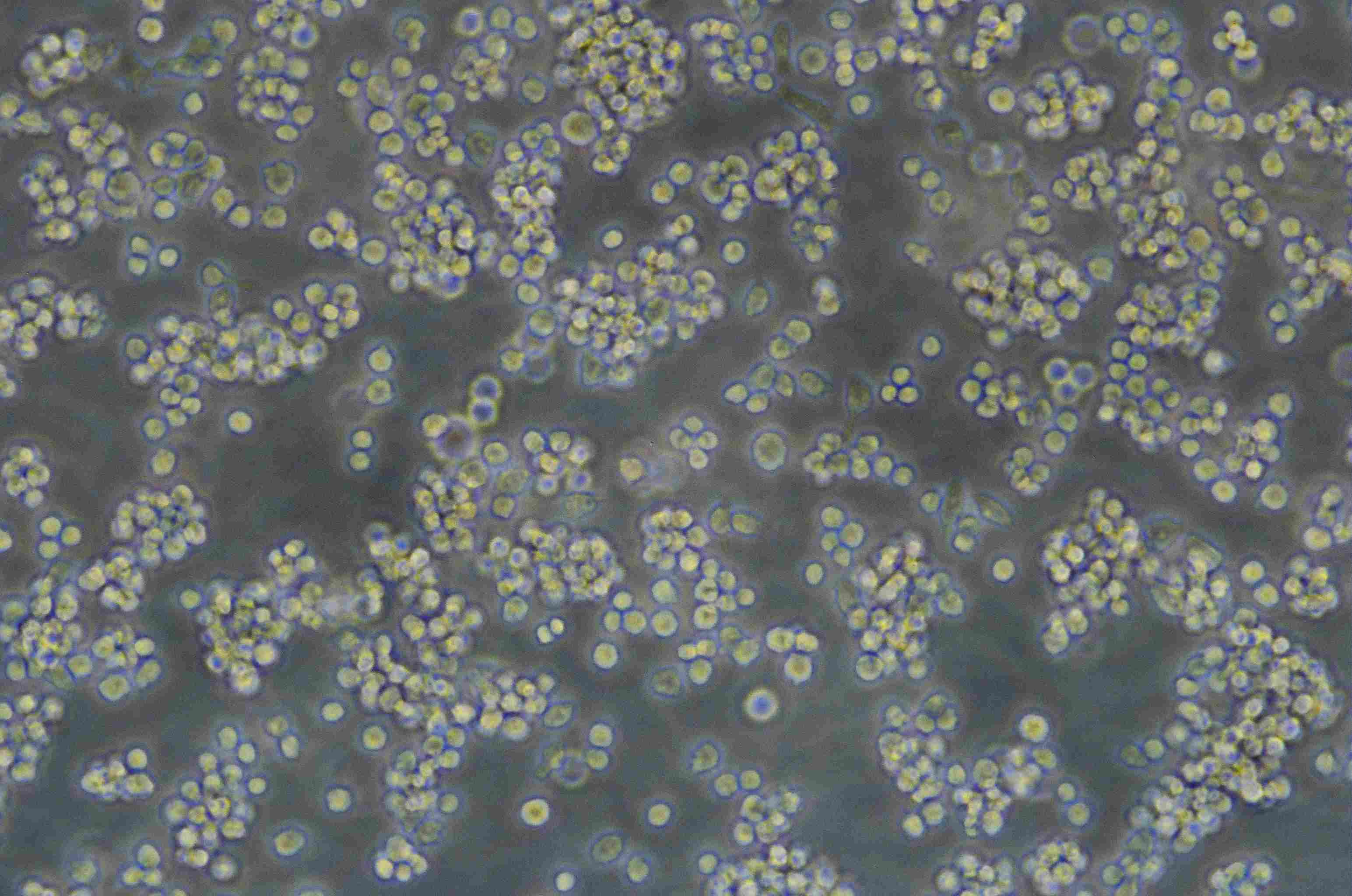 MyLa 2059 人皮肤T淋巴细胞瘤细胞系