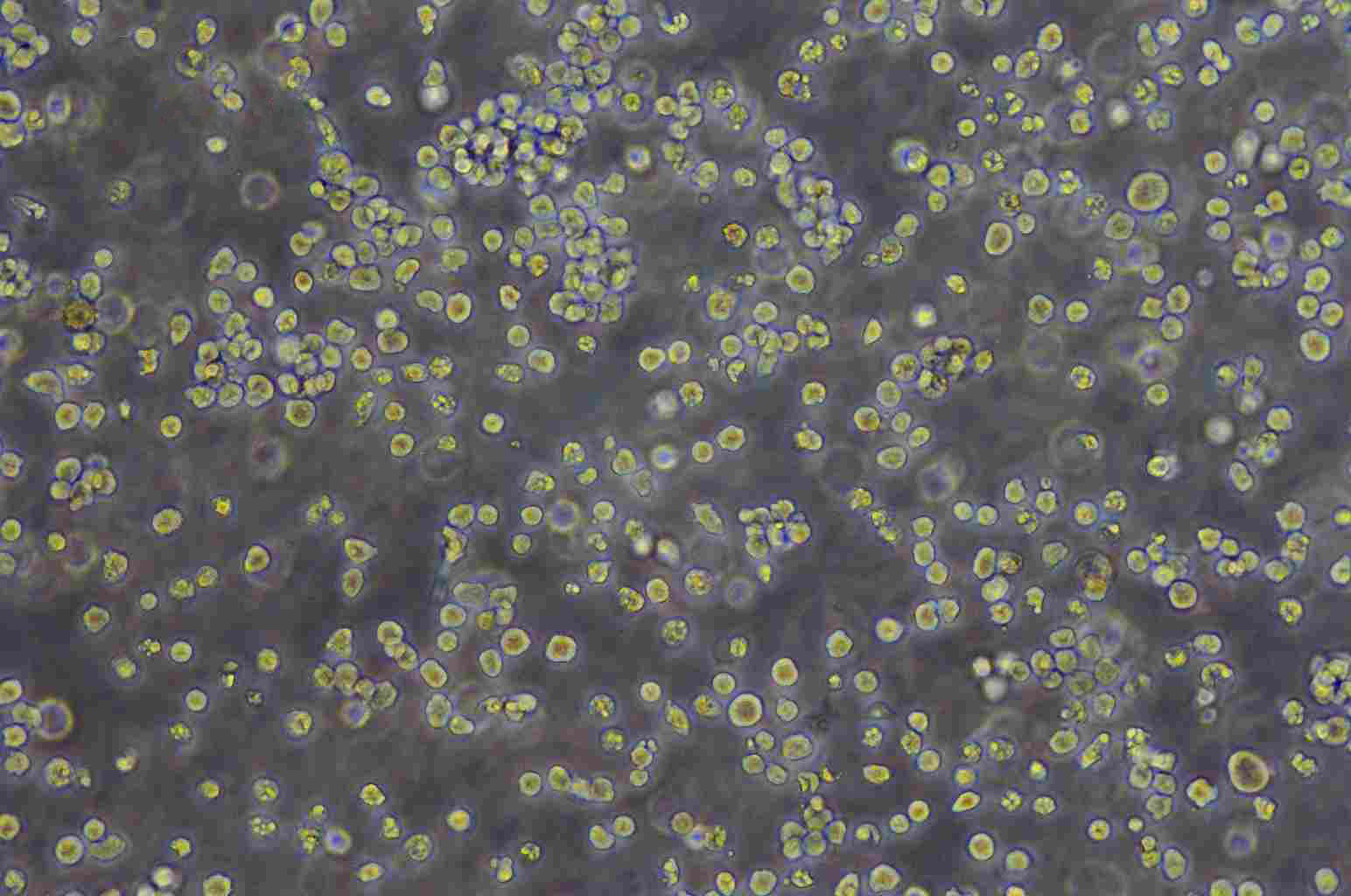 OCI-AML-5 人急性髓细胞性白血病细胞系