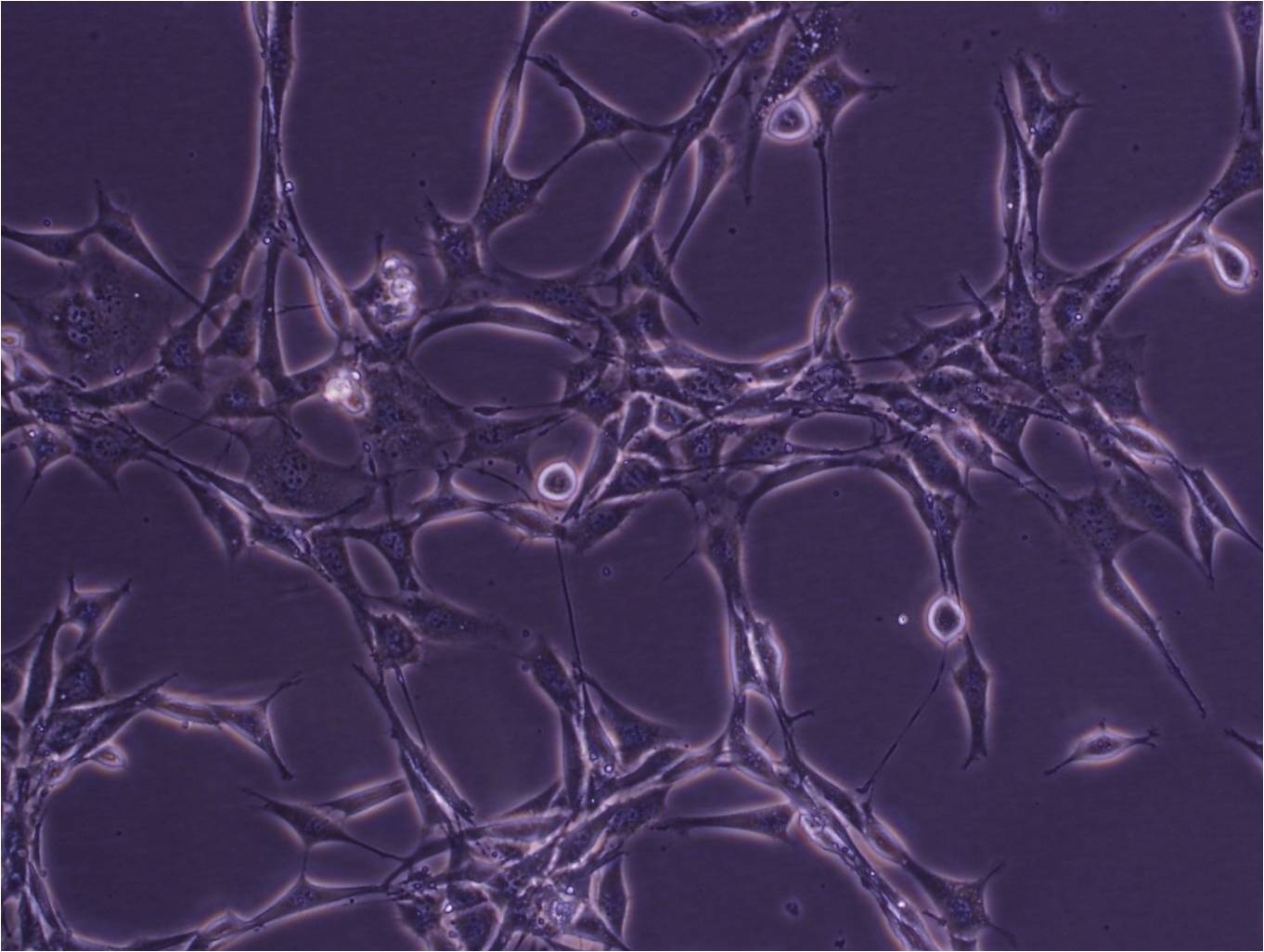 T24细胞：人膀胱移行细胞癌细胞系