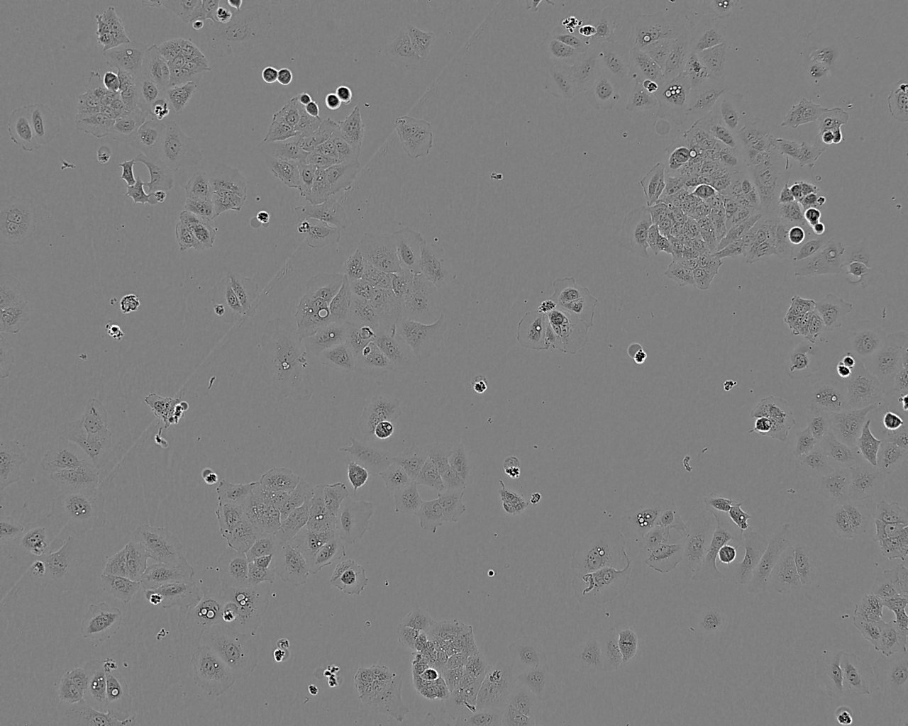 A2780细胞：人卵巢癌细胞系