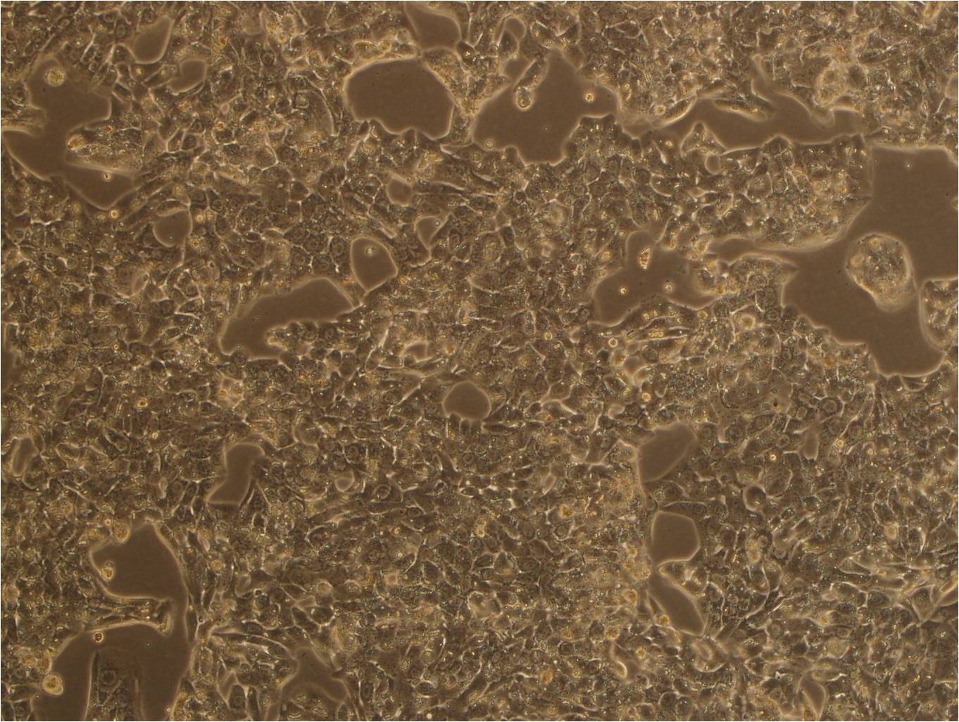 NCI-H187 cell line人视网膜母细胞瘤细胞系