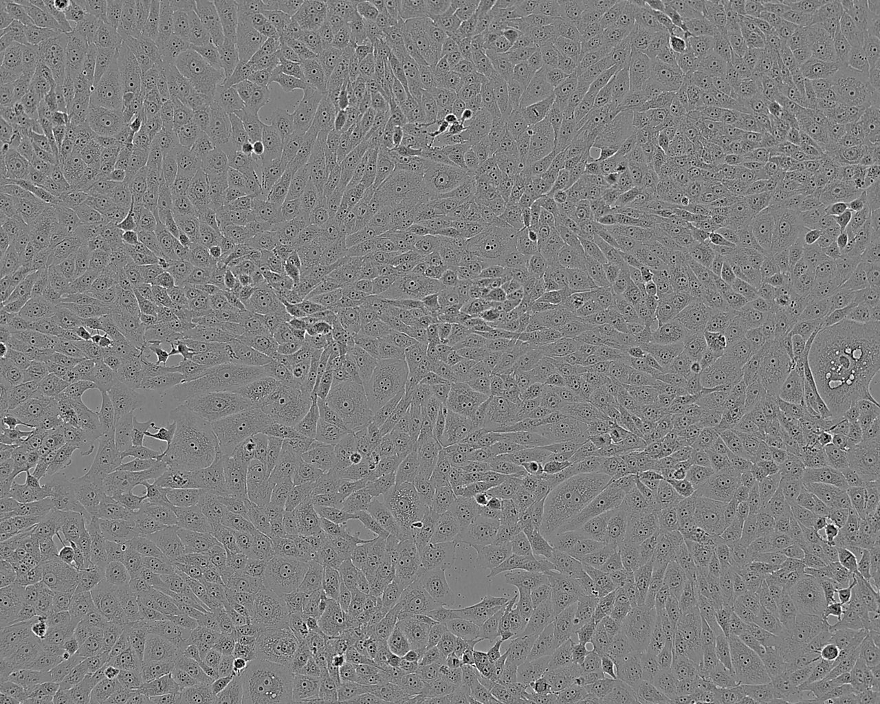 RWPE-1细胞：人正常前列腺上皮细胞系