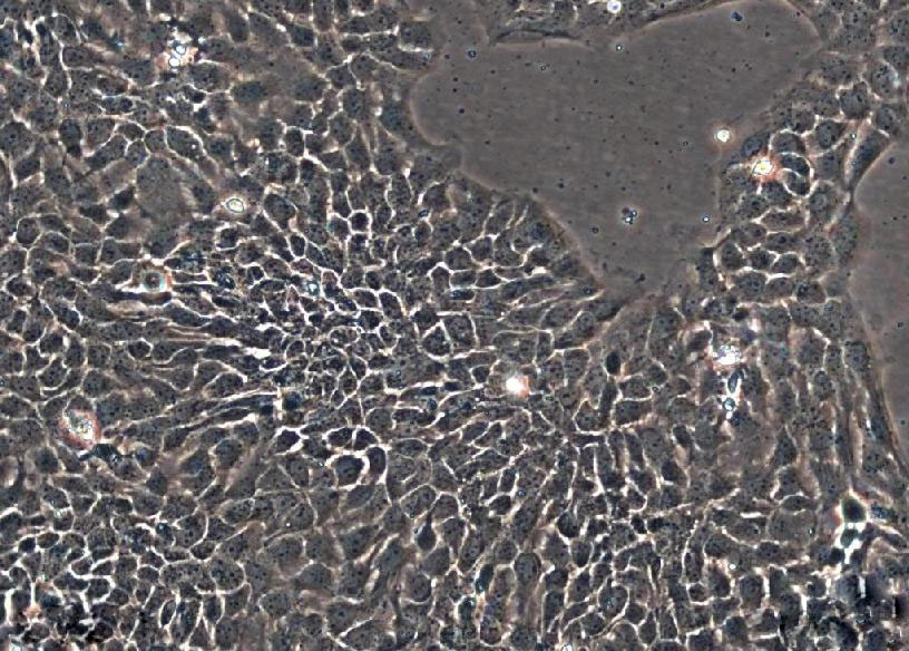 KP-N-NS细胞：人肾上腺神经母细胞瘤细胞系