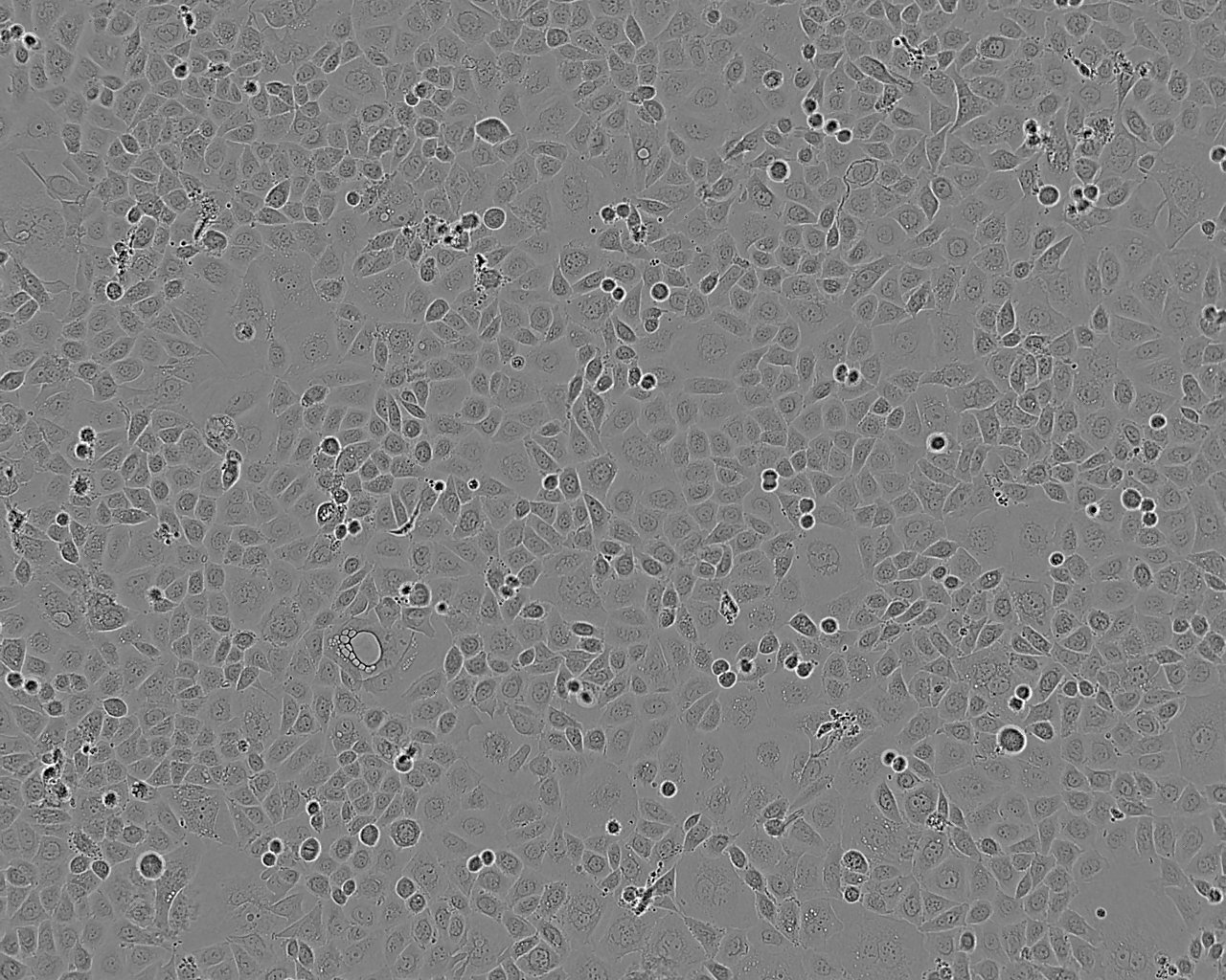 KLE细胞：人子宫内膜癌细胞系